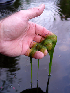Picture: Pond String Algae In Rochester, Monroe County NY